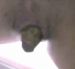 A close-up Bowlcam scene of a female shitting ass from Germany. About half a minute.